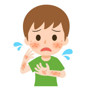 皮ふの赤みとかゆみ